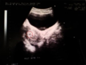 Hasil USG tanggal 21 Mei 2013 - 7 minggu :)